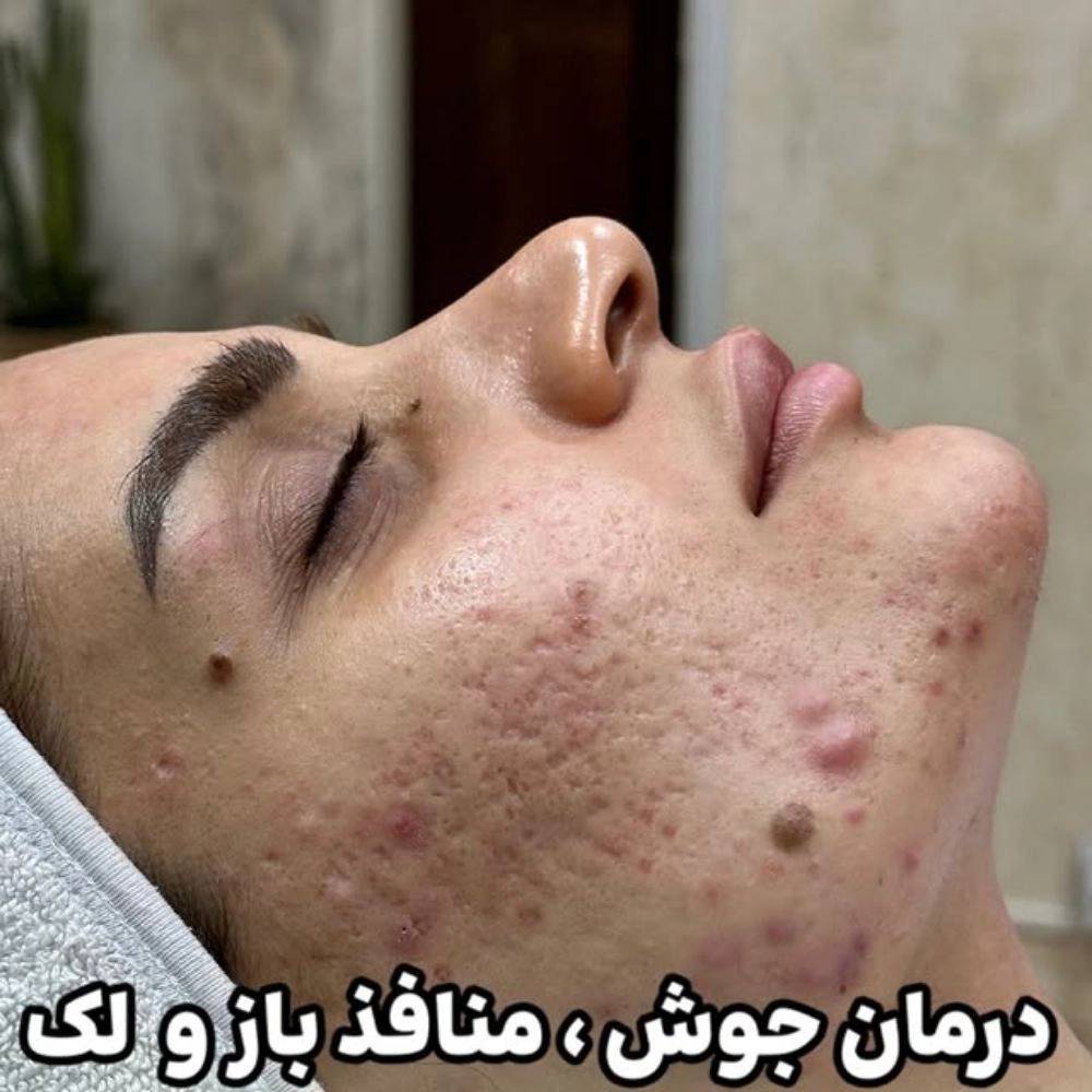 1772257842468.webp