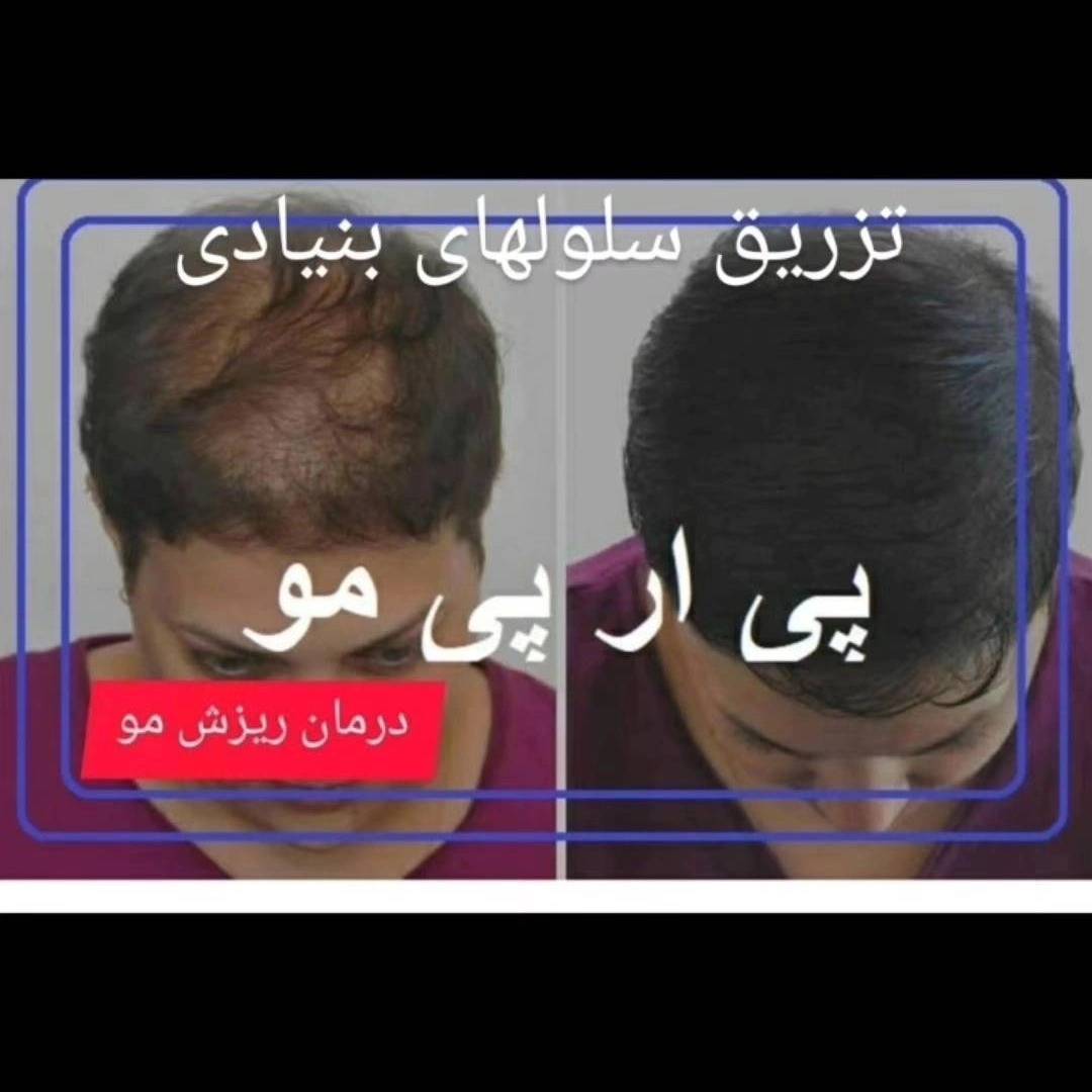 1776755689914.webp