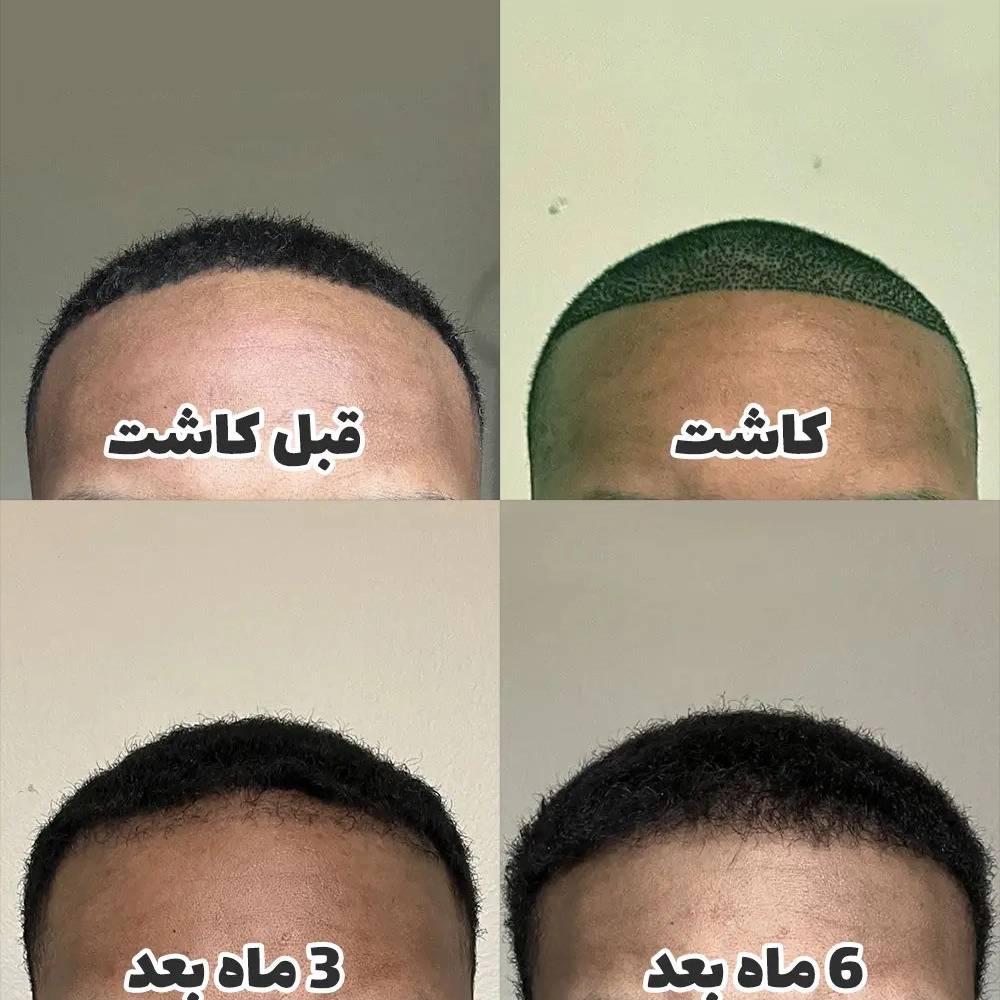 1778313595280.webp