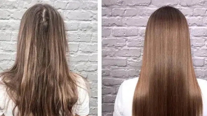 کلینیک زیبایی احیا، اسکالپ سر و پروتئین تراپی مو در ساری