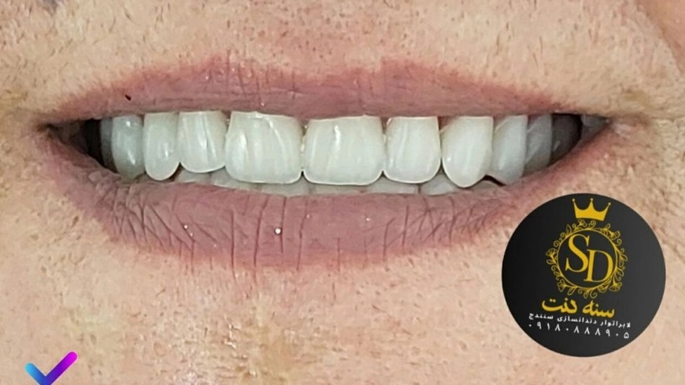 لابراتوار دندانسازی سنه دنت در سنندج