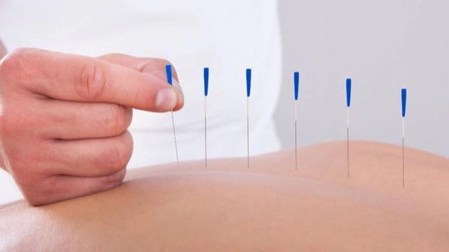 بهترین کلینیک طب سنتی و سوزنی شیراز