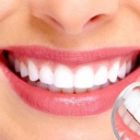 کلینیک شهابی، متخصص زیبایی و ترمیم دندان در تهران