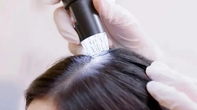 پاکسازی کف سر برای جلوگیری از ریزش مو در مشهد